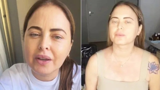 A 2 años de la muerte de Silvina Luna: La modelo y actriz que visibilizó los riesgos de las cirugías estéticas