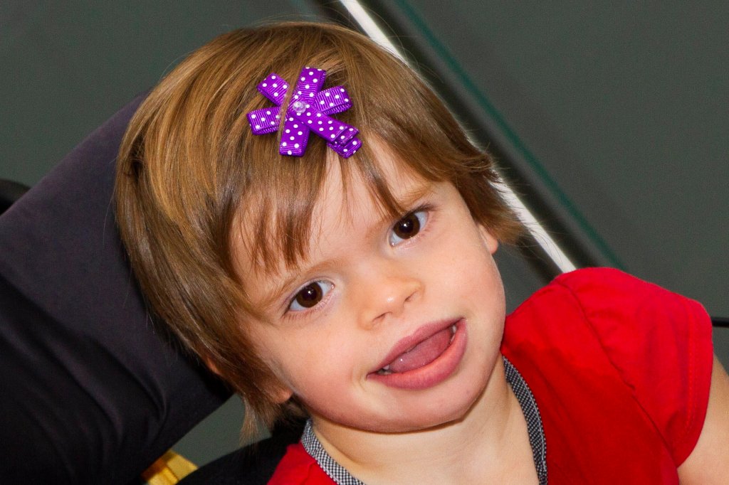 ¿Qué hay detrás del Síndrome de Kleefstra? Una mirada a un trastorno genético poco común